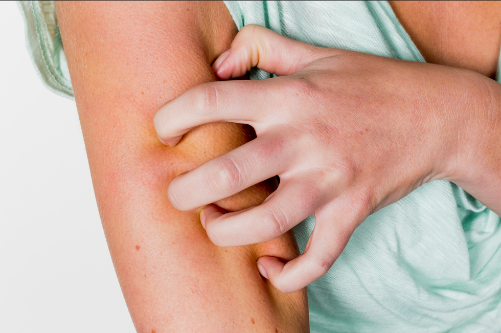 persona che si gratta braccio affetto da Dermatite Atopica ( close up)