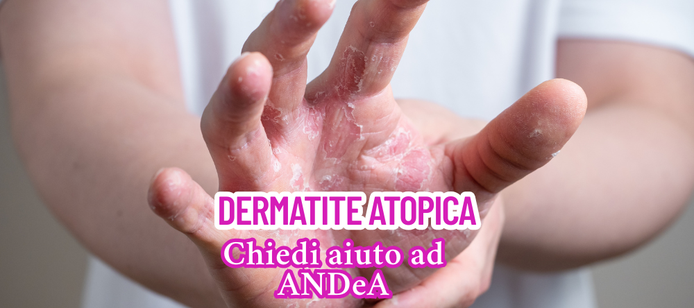 dermatite atopica chiedere aiuto ad andea