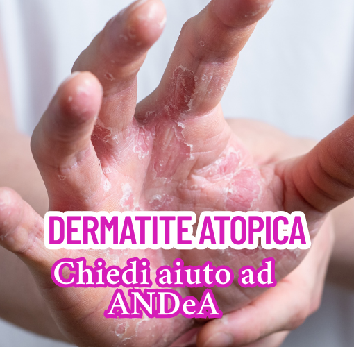 dermatite atopica chiedere aiuto ad andea