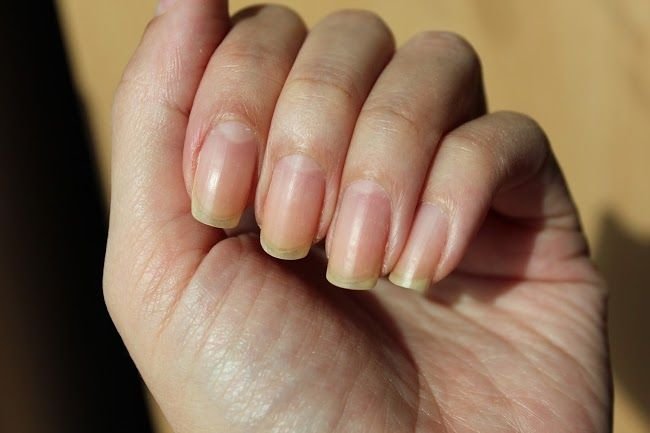 primo piano di mano e unghie per il problema delle cuticole che crescono troppo