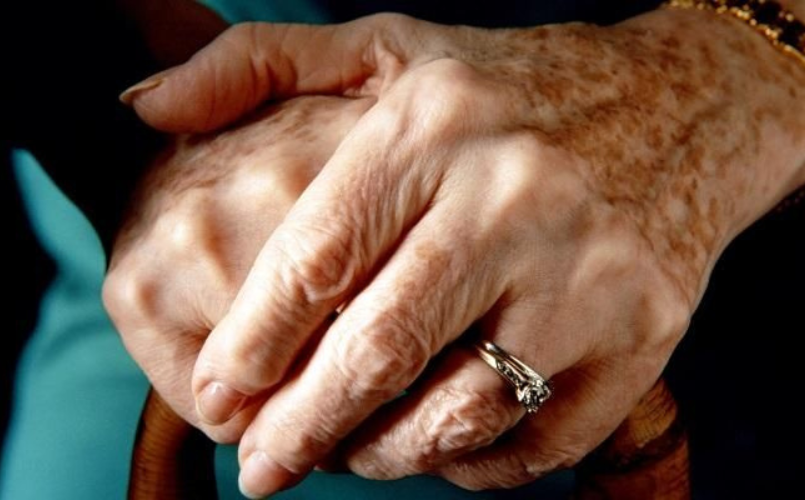 mani di persona anziana in primo piano con macchie senili. concetto di mani e carenze nutrizionali, mani e problemi di pelle ,