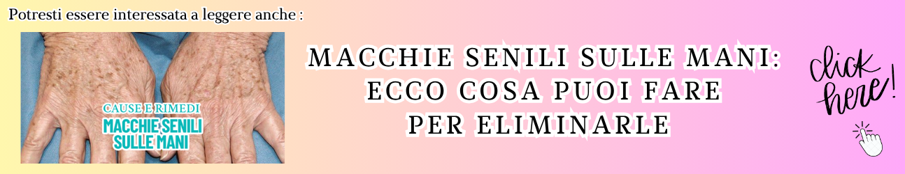 guida sul problema delle machhie senili sulle mani e su come risolverlo + concetto di mani e carenze nutrizionali
