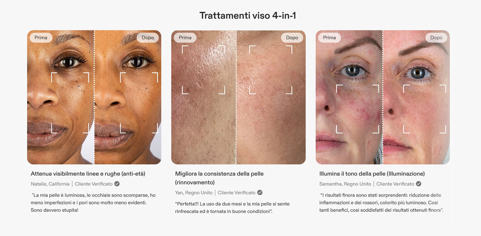 Prima e dopo su vari visi, della apllicazione della maschera led currentbody 4 in 1- concetto maschere led viso funzionano davvero
