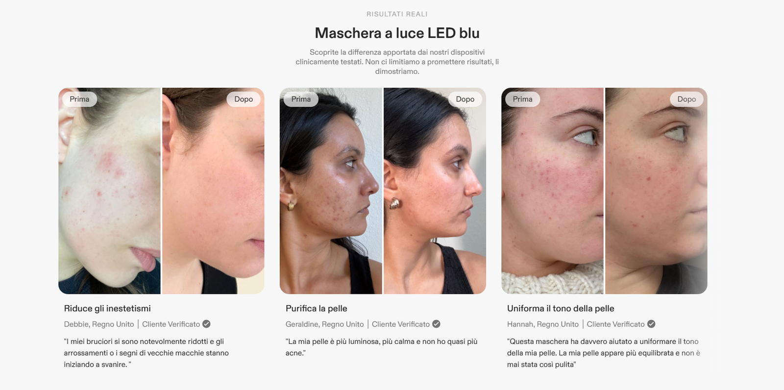 Prima e dopo su vari visi, della apllicazione della maschera led currentbody 4 in 1- concetto maschere led viso funzionano davvero
