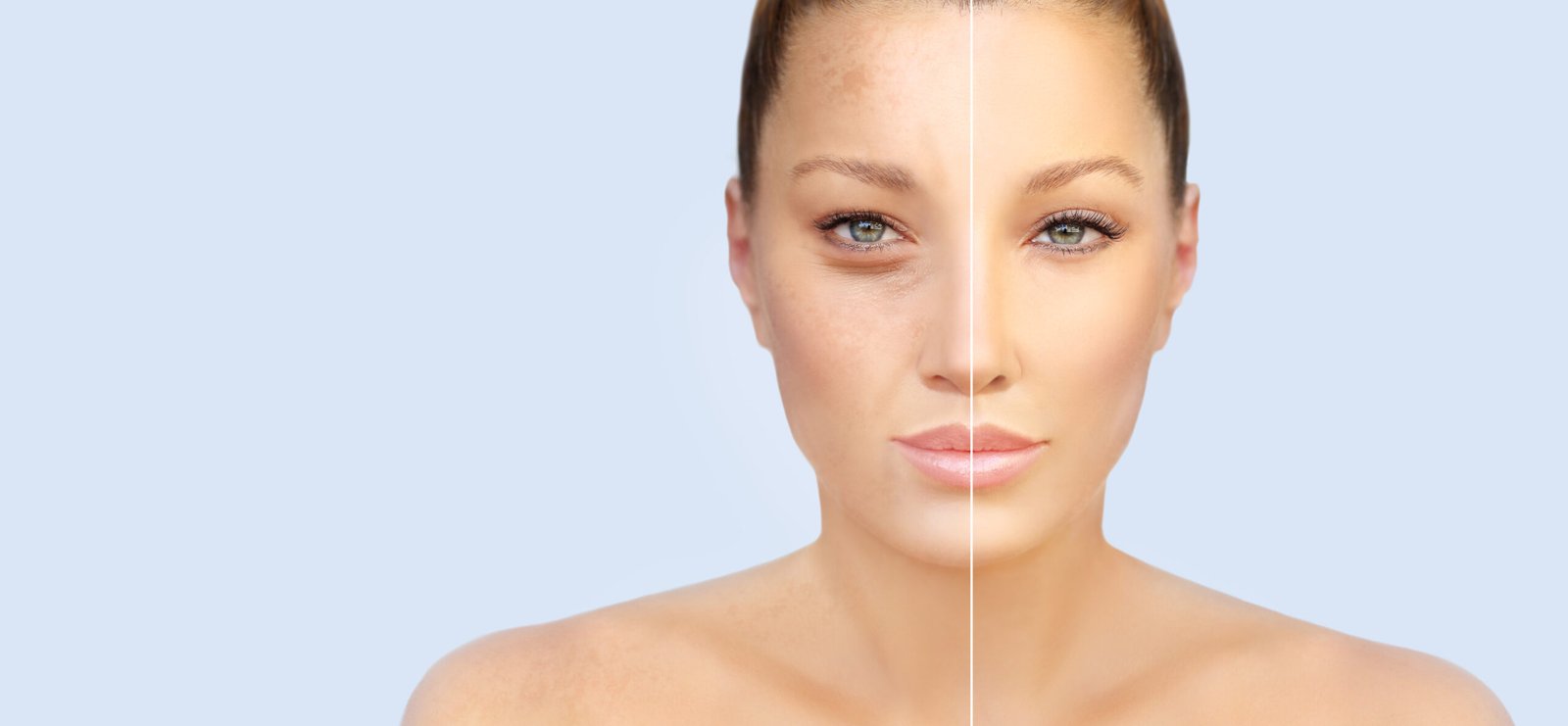 primo piano di donna che illustra i danni del photoaging e i benefici dell'uso dei sieri al collagene: metà viso è invecchiata e metà è giovane
