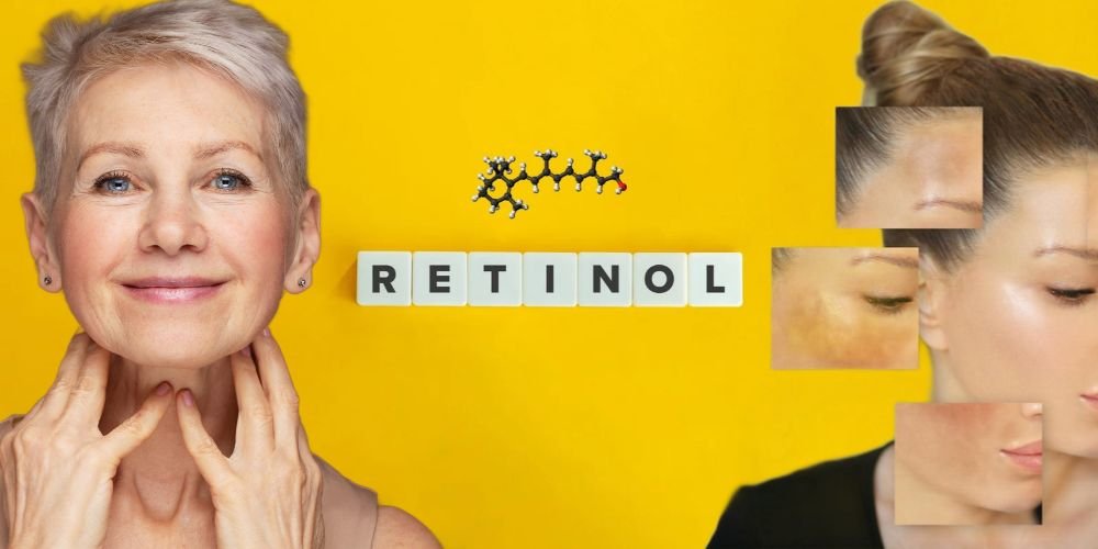 retinolo e macchie : immagine con due donne mature e con macchie e scritta retinol con simobolo chimico